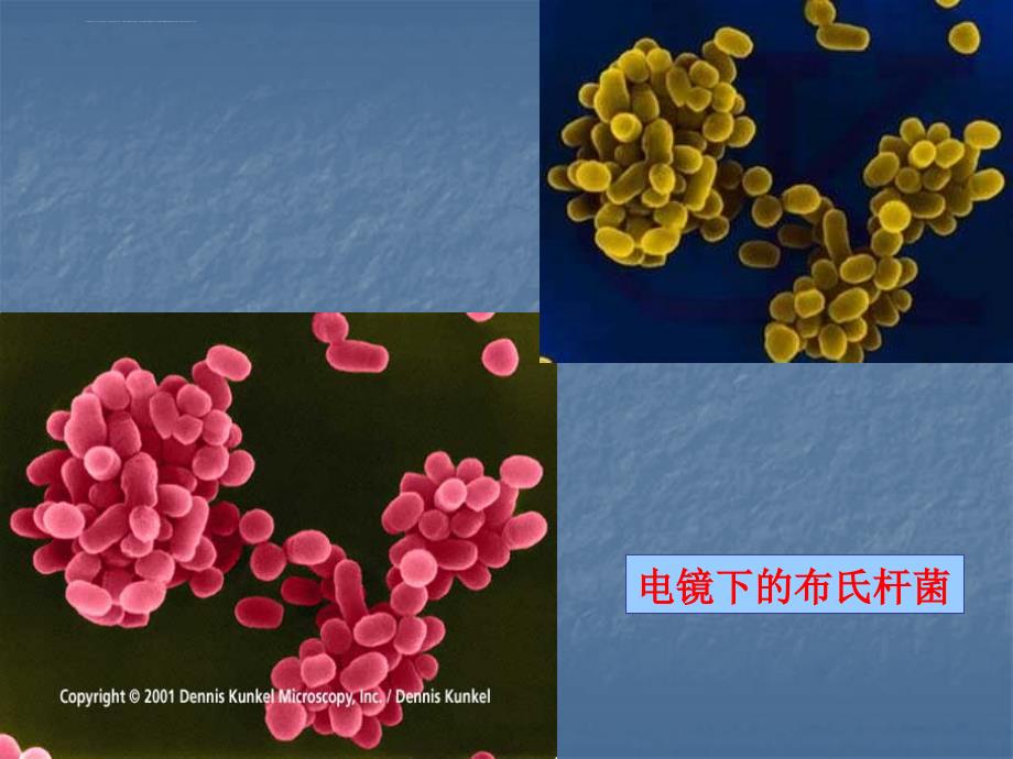 布氏杆菌病2课件_第4页