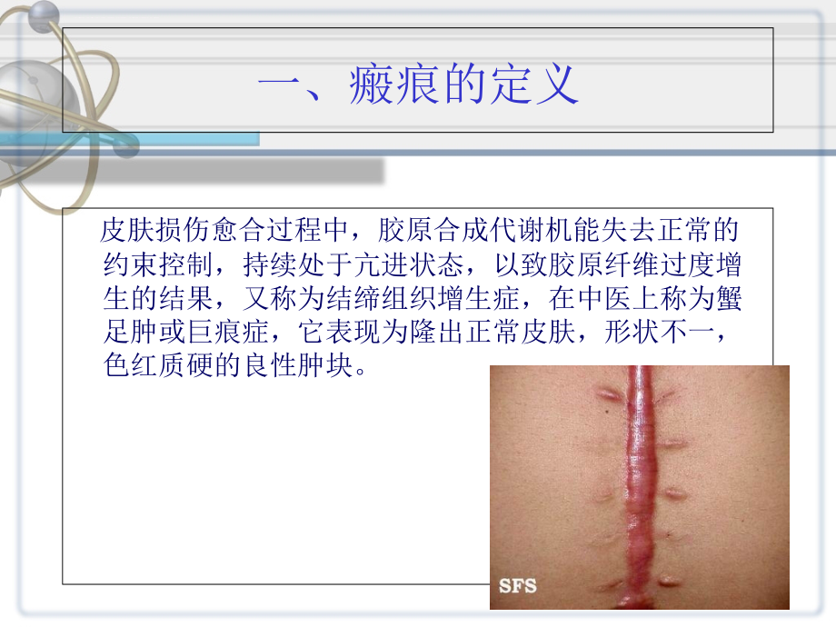 济南106医院分享疤痕的国内外研究进展课件_第2页