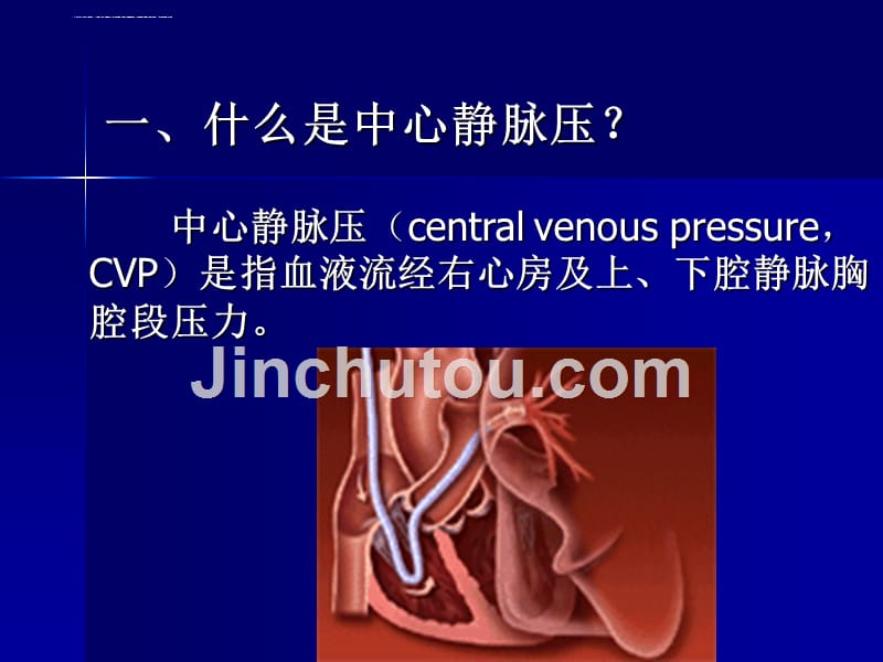 中心静脉压(cvp)的监测和护理课件_第3页