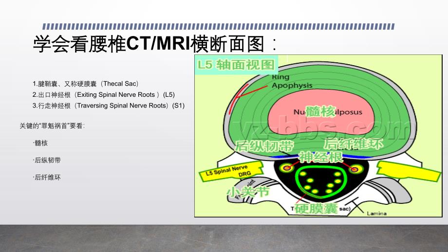 腰椎间盘突出影像_第2页