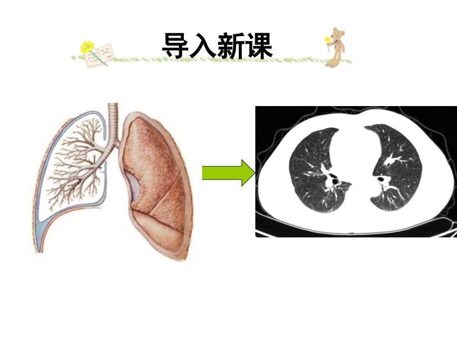 正常胸部-课件_第5页