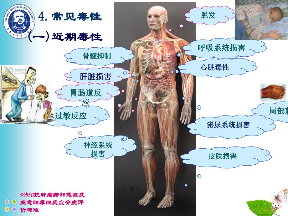 zcz-化疗常见毒副反应及处理课件_第2页