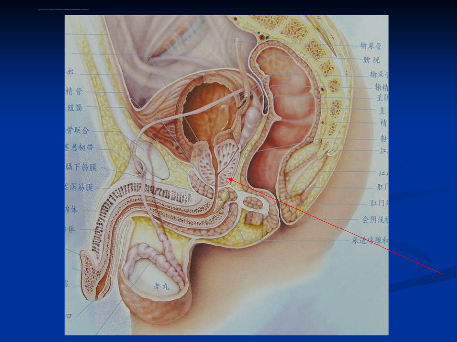 前列腺癌的mr诊断课件_第3页