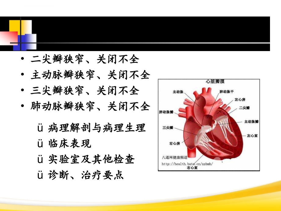 循环系统第6节-心脏瓣膜病课件_第4页