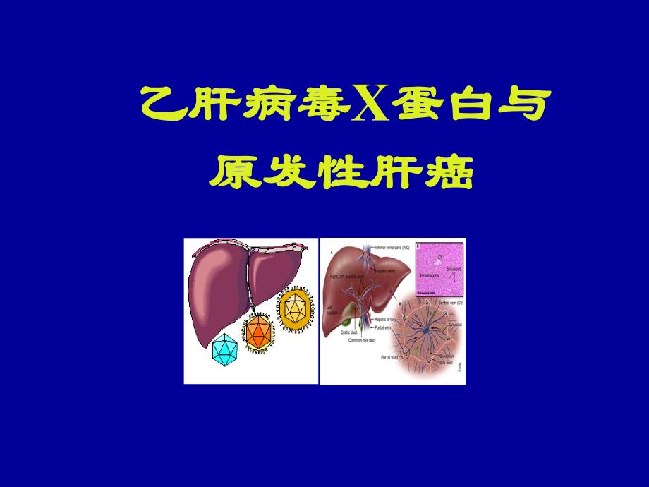 hbv-x-蛋白与原发性肝癌_第1页