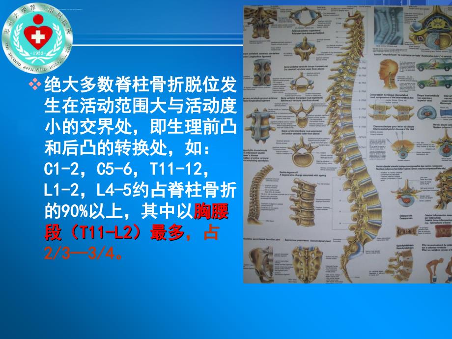 脊柱骨折和脊髓损伤1课件_第3页