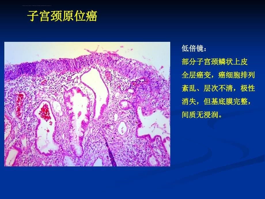 生殖系统疾病课件_第5页