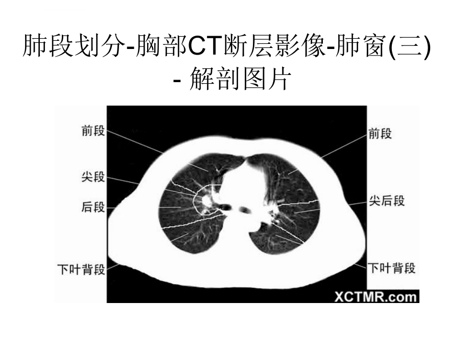 胸、腹、盆腔ct课件_第4页