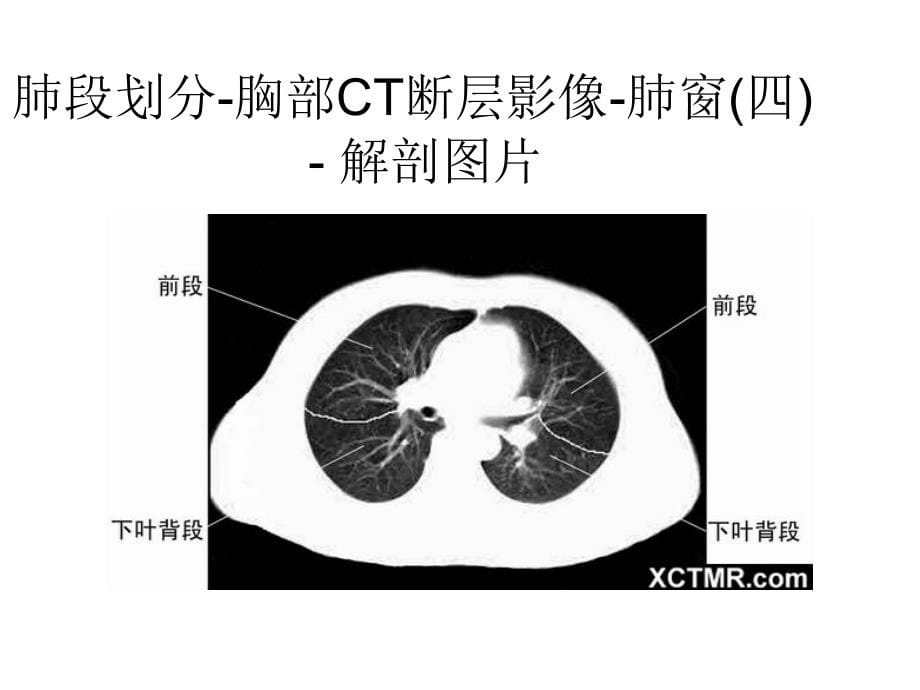 胸、腹、盆腔ct课件_第5页