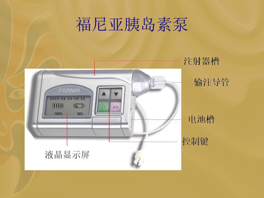 福尼亚胰岛素泵操作课件_第2页