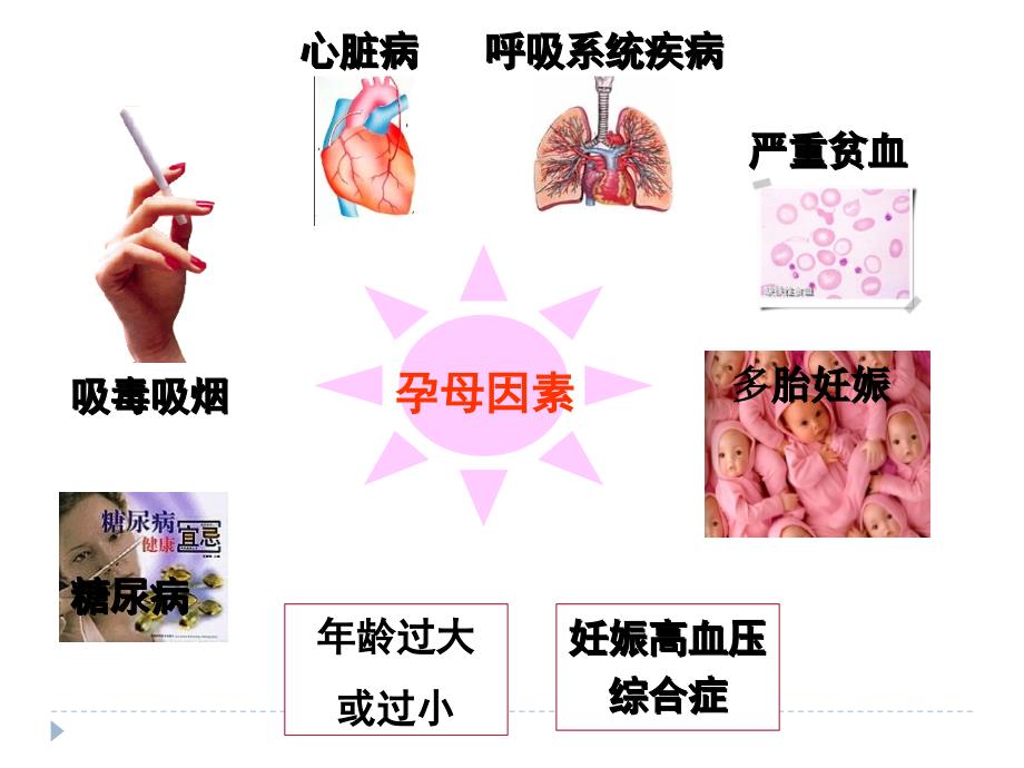 新生儿窒息ppt儿科医学课件课件_第4页