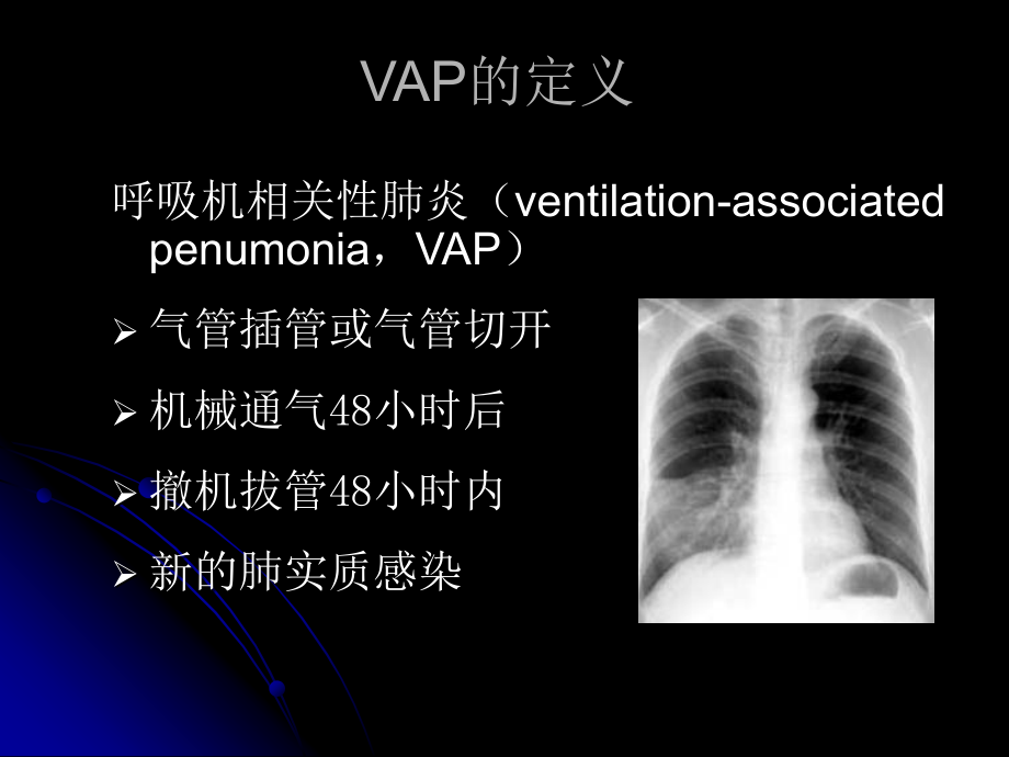 呼吸机相关性肺炎2245_第2页