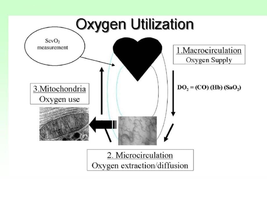 氧代谢是血流动力学管理的目标课件_第5页