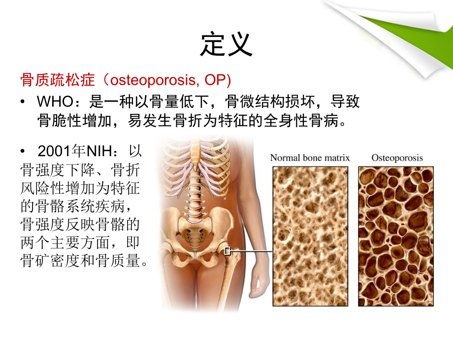 老年科-原发性骨质疏松症诊治指南课件_第2页