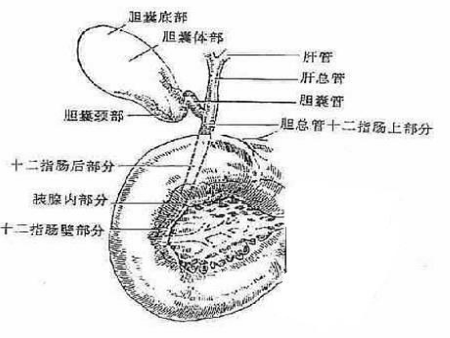 胆-系-结-石-和-感-染课件_第3页