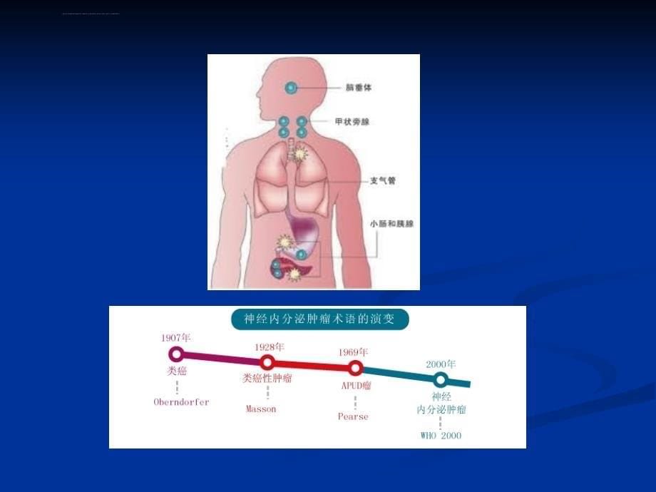 胃肠胰神经内分泌肿瘤课件_第5页