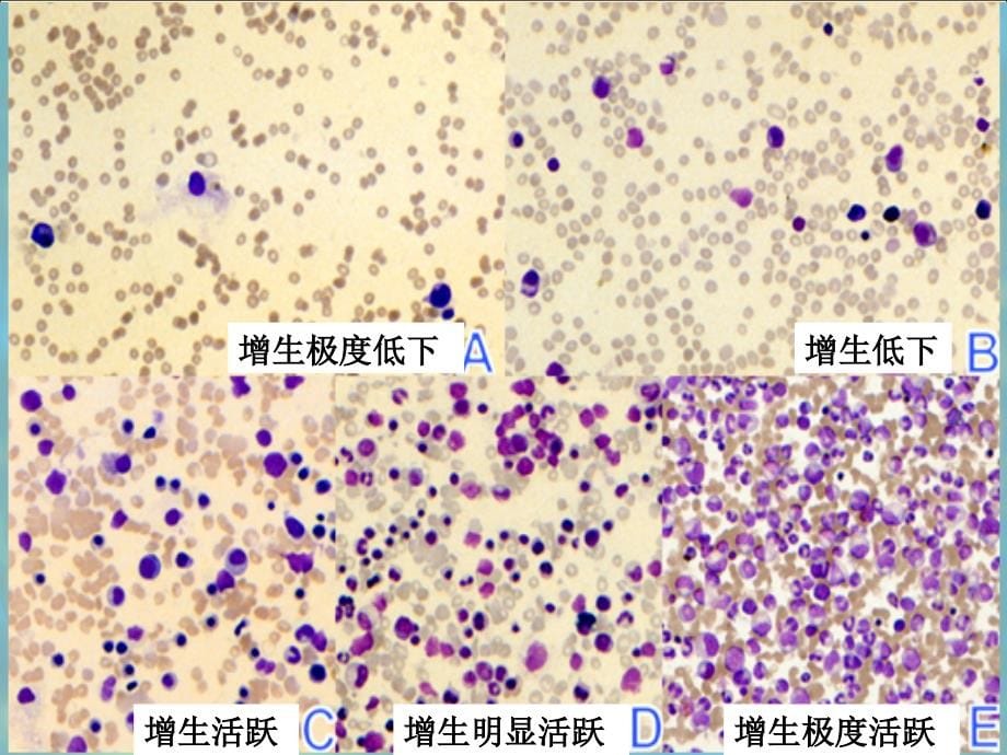 骨髓象检查课件_第5页