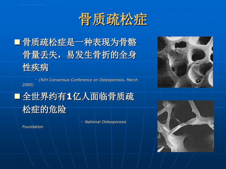 椎体成形术治疗中老年人胸腰压缩性骨折(1)课件_第4页