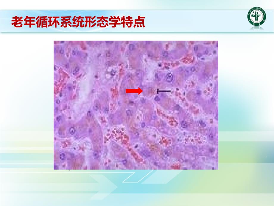 老年心血管课件_第4页