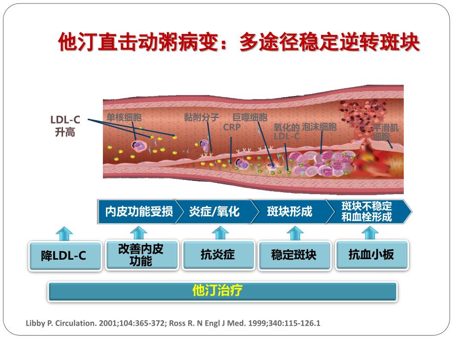 他汀与卒中的治疗3_第2页