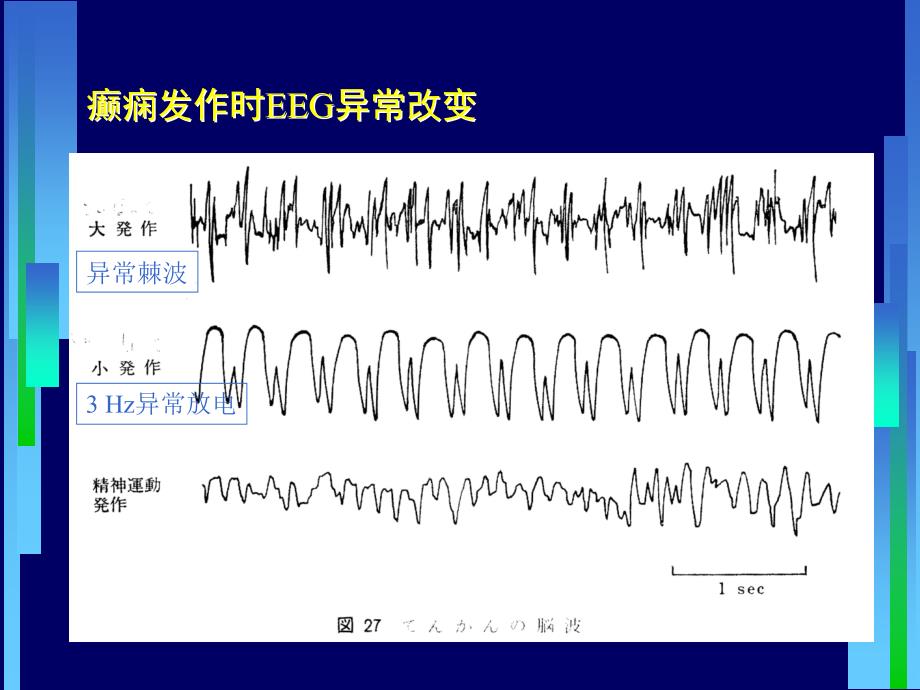 药理学-抗癫痫药课件_第4页