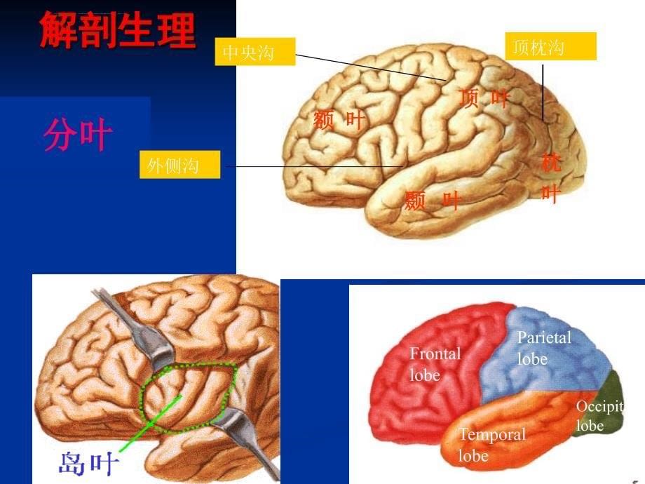 神经系统定位诊断(脑叶)课件_第5页