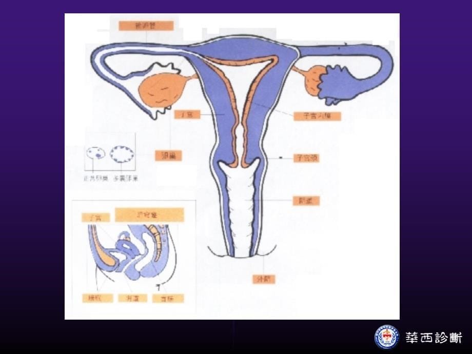 女性生殖器检查相关知识-ppt诊断学课件_第5页