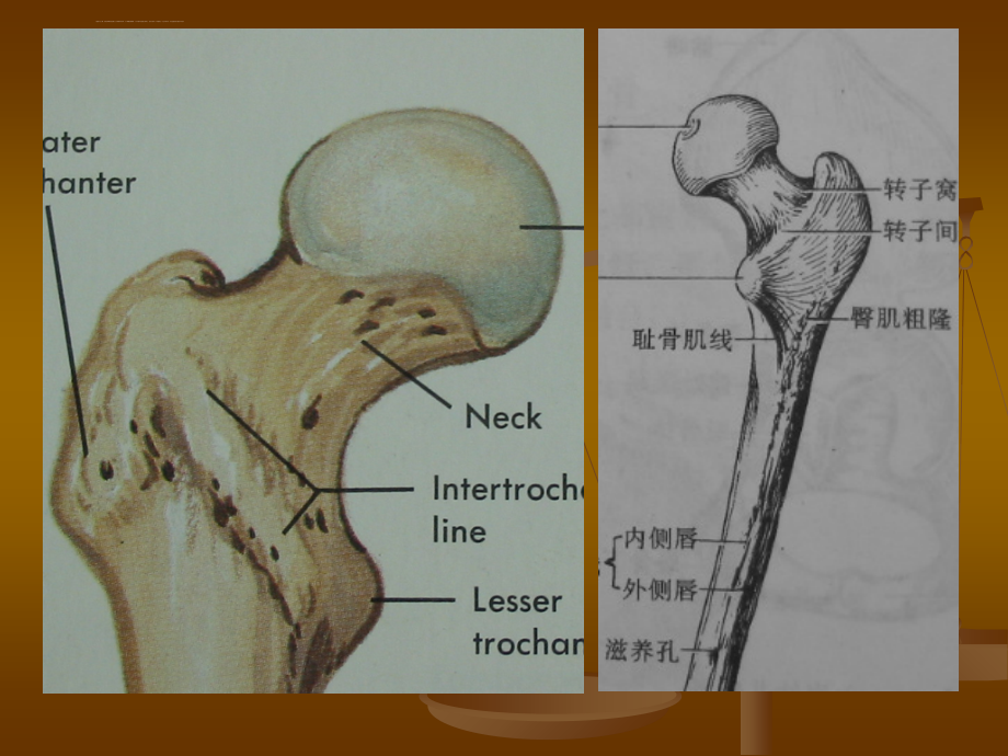 股骨头缺血坏死的影像学诊断—讲稿课件_第3页