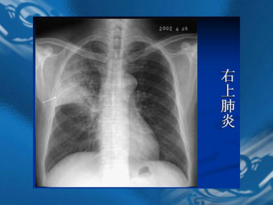 2013年执业医师资格考试“实践技能”影像学辅导资料_第4页