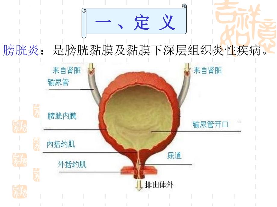 膀胱炎模型建立与诊疗课件_第2页