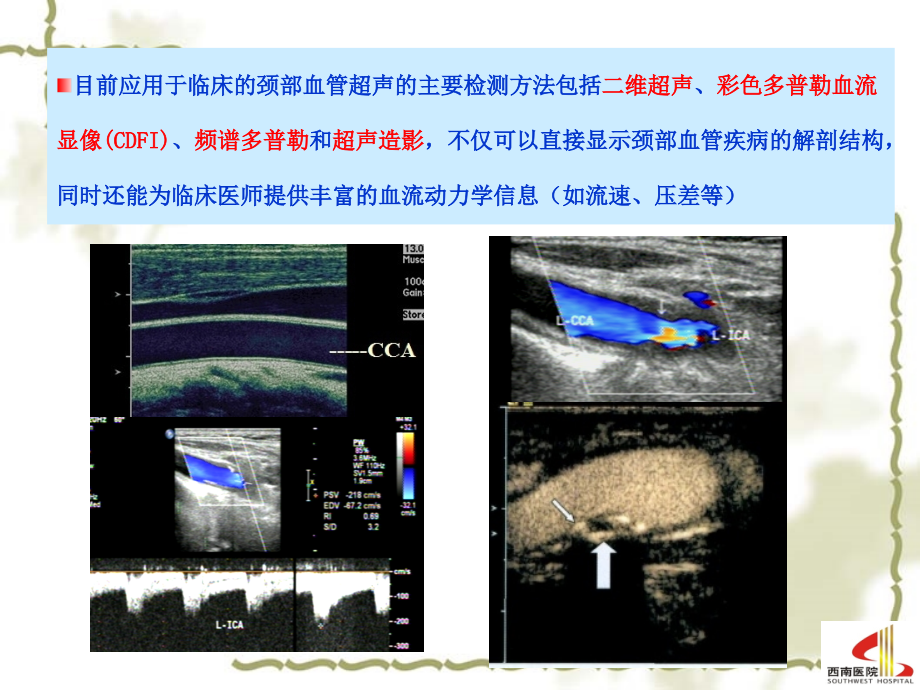 颈部血管超声检查-2013课件_第3页
