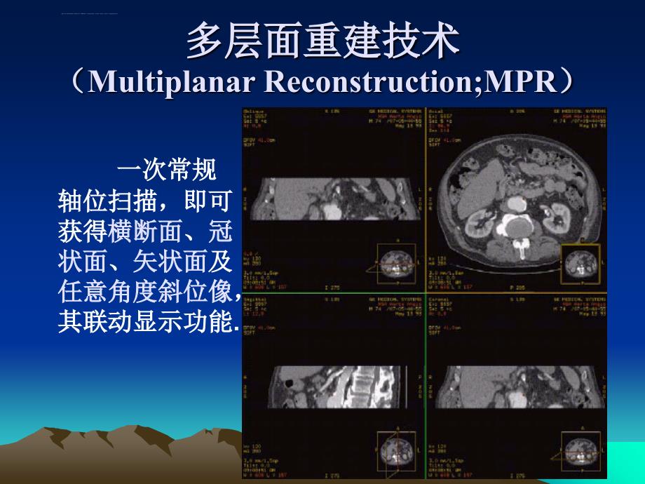 螺旋ct影像后处理临床应用课件_第4页