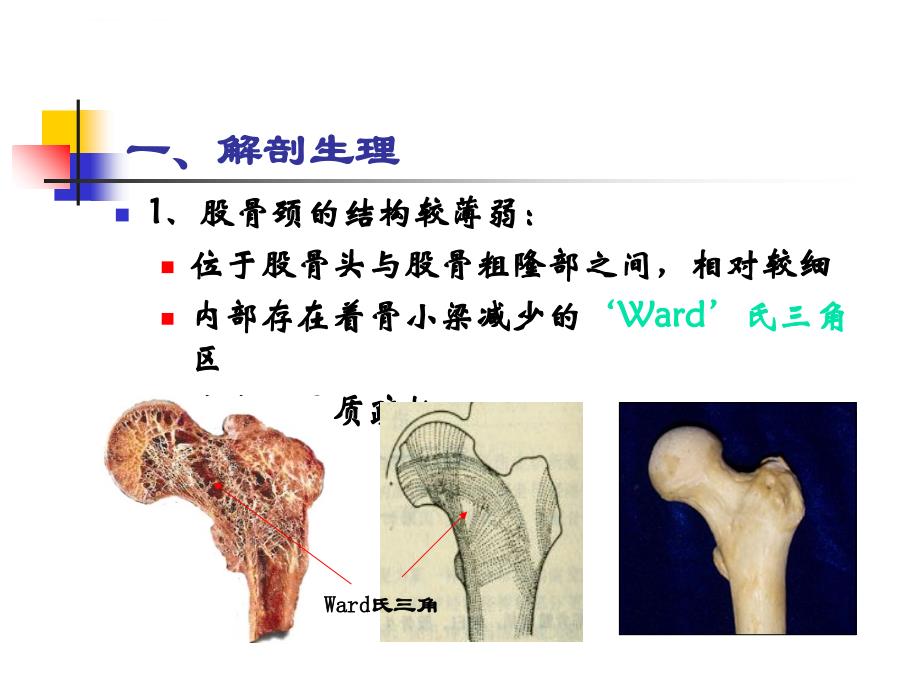 股骨颈骨折概述课件_第2页