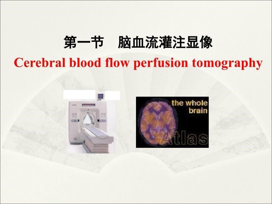 神经系统核医学课件_第5页