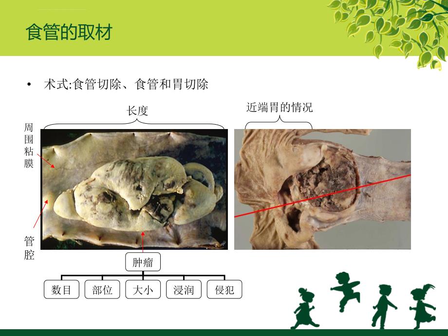 消化道取材课件_第4页