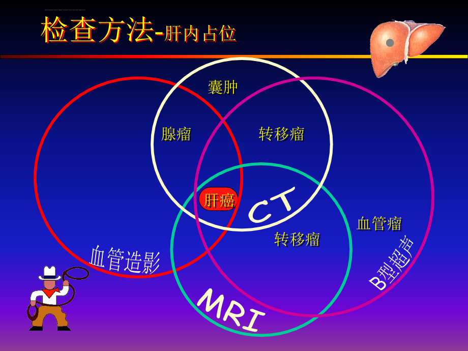 肝胆胰的影像学诊断课件_第4页