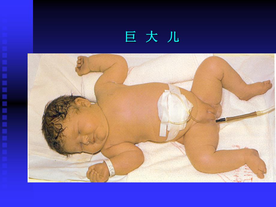 母婴护理及保健-新生儿护理与保健２课件_第3页