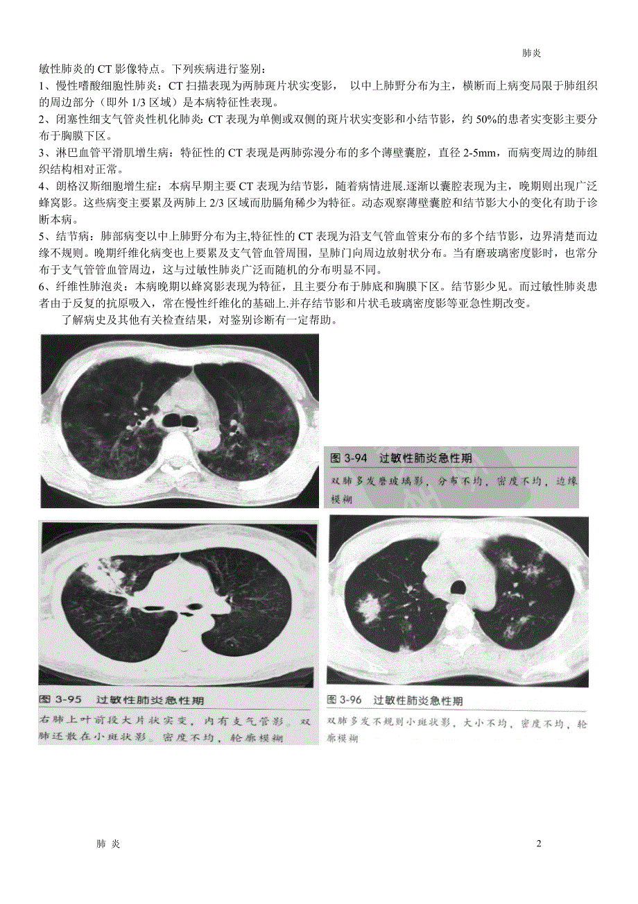 肺炎材料：过敏性肺炎CT征象_第2页