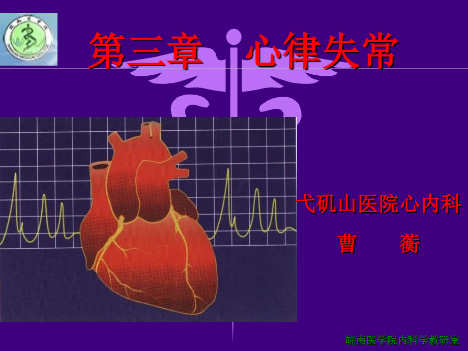 心脏病学-心律失常课件_第2页