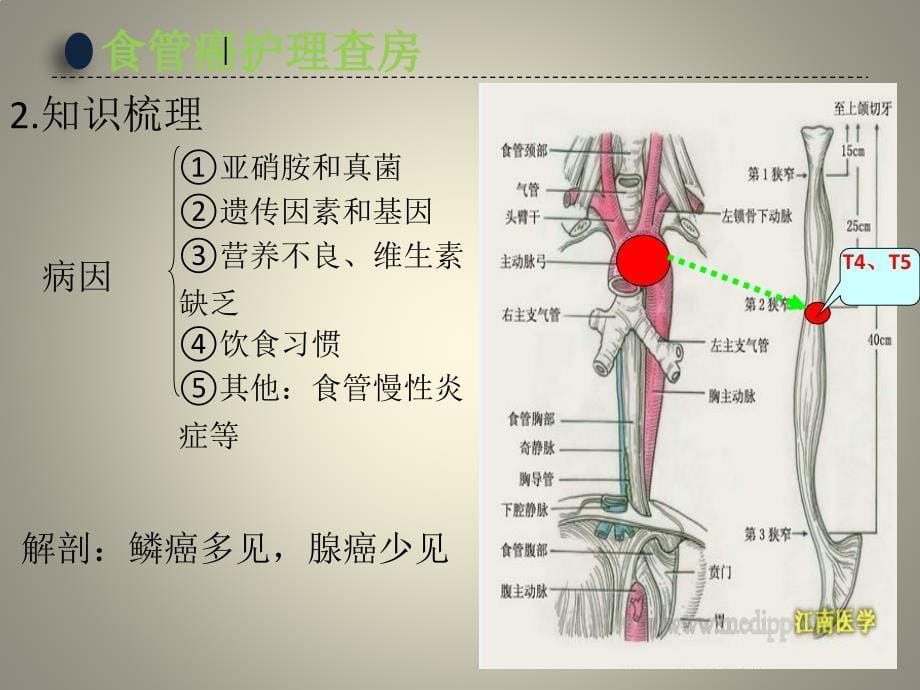 食管癌护理查房2课件_第5页