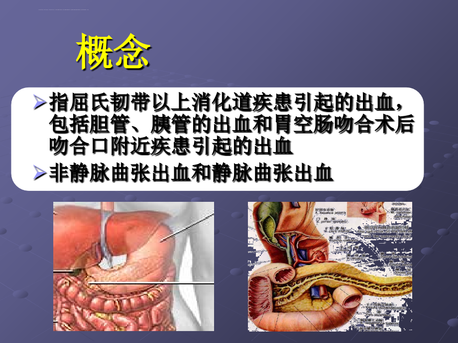 朱峰-上消化道出血的诊治基础和进展课件_第2页