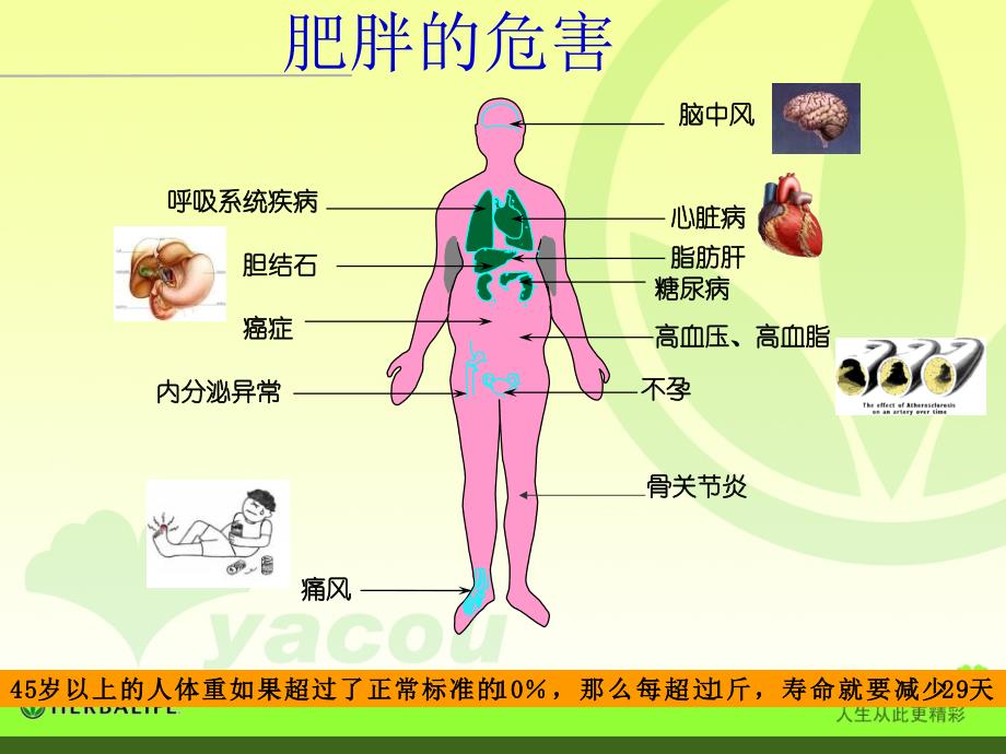 肥胖与健康课件_第4页