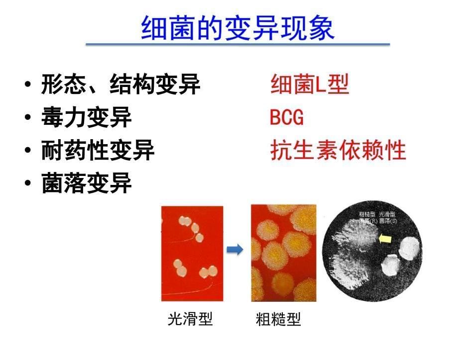 2015-第4章-细菌的遗传和变异_第5页