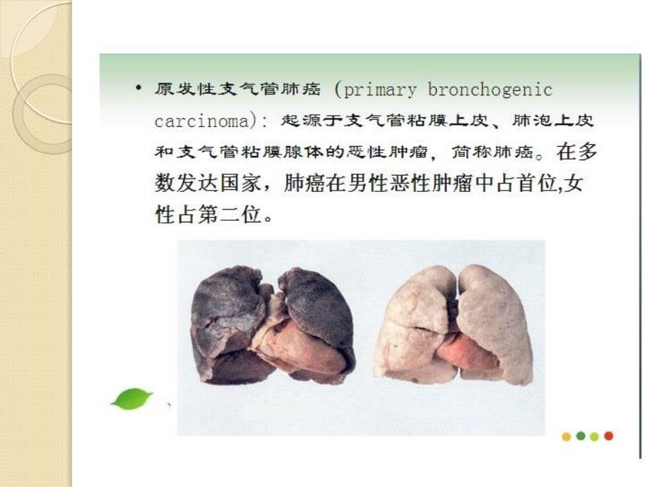 肺癌健康教育课件_第5页