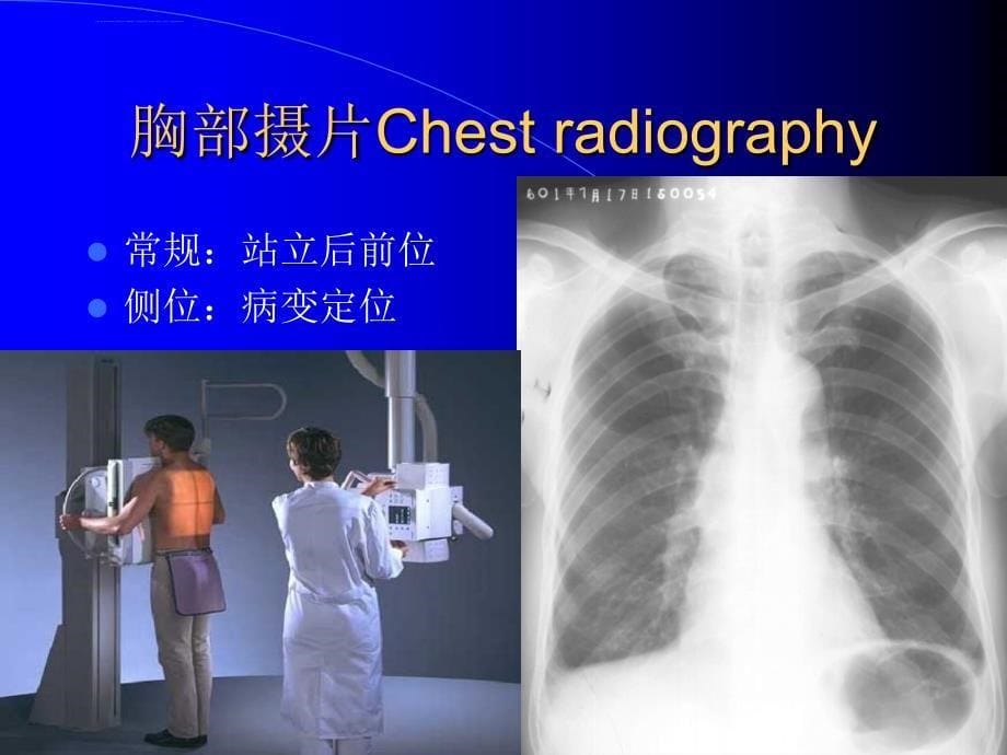 肺与纵隔-检查与正常课件_第5页