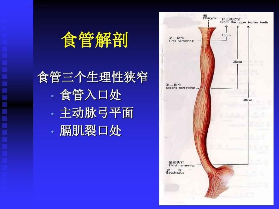 食道癌术后护理课件_第5页