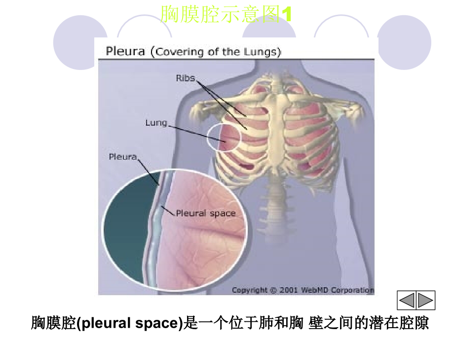呼吸病学-胸膜疾病胸腔积液课件_第3页