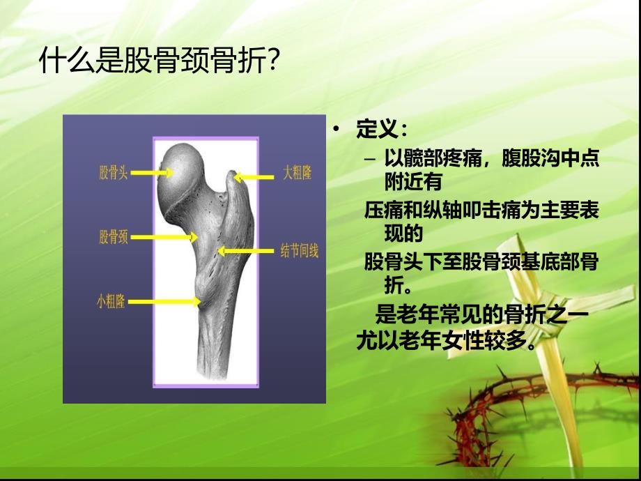 股骨颈骨折的护理-zj课件_第1页