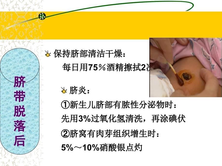 新生儿护理及母乳喂养ppt（2）_第5页