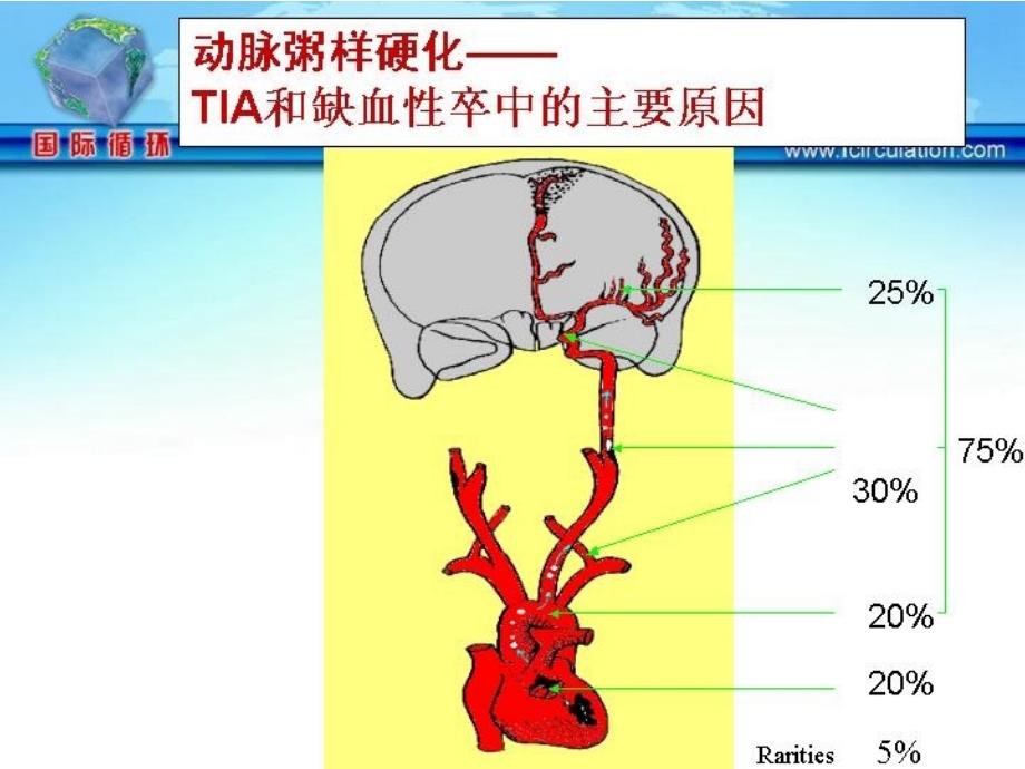 缺血性卒中的抗凝治疗-王拥军_第2页